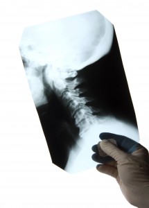 back and neck injuriy settlements